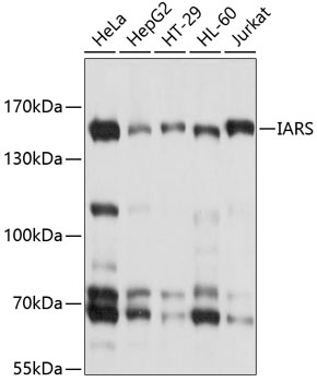Western blot - IARS Polyclonal Antibody 