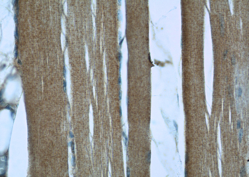Immunohistochemistry of paraffin-embedded human skeletal muscle slide using Catalog No:112221(LIFR Antibody) at dilution of 1:50 (under 40x lens)