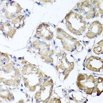 Immunohistochemistry - MGAT1 Polyclonal Antibody 