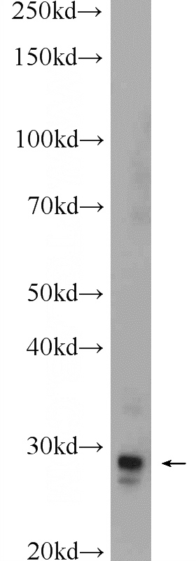 mouse brain tissue were subjected to SDS PAGE followed by western blot with Catalog No:112798(MPZL3 Antibody) at dilution of 1:1000