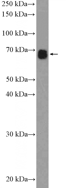 mouse liver tissue were subjected to SDS PAGE followed by western blot with Catalog No:116257(TOX2 Antibody) at dilution of 1:300