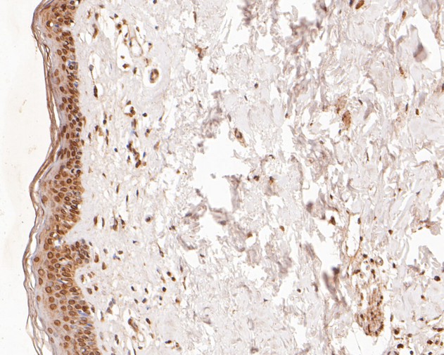 Fig3:; Immunohistochemical analysis of paraffin-embedded human skin tissue using anti-TMX4 antibody. The section was pre-treated using heat mediated antigen retrieval with sodium citrate buffer (pH 6.0) for 20 minutes. The tissues were blocked in 5% BSA for 30 minutes at room temperature, washed with ddH; 2; O and PBS, and then probed with the primary antibody ( 1/400) for 30 minutes at room temperature. The detection was performed using an HRP conjugated compact polymer system. DAB was used as the chromogen. Tissues were counterstained with hematoxylin and mounted with DPX.