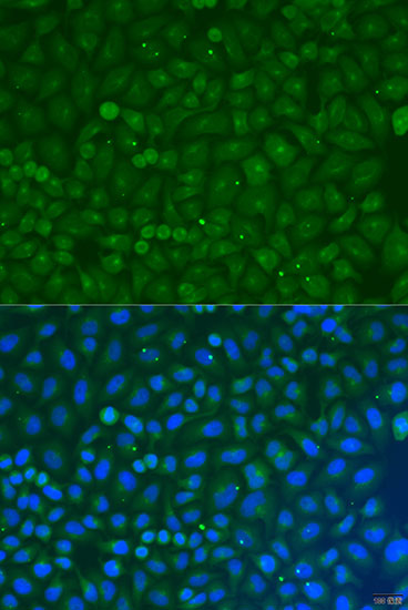 Immunofluorescence - COG4 Polyclonal Antibody 