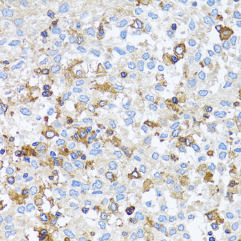 Immunohistochemistry - ACTR2 Polyclonal Antibody 