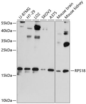 Western blot - RPS18 Polyclonal Antibody 