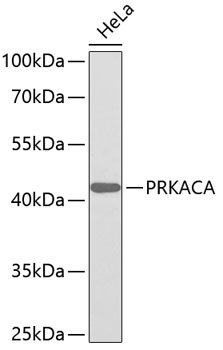 Western blot - PRKACA Polyclonal Antibody 