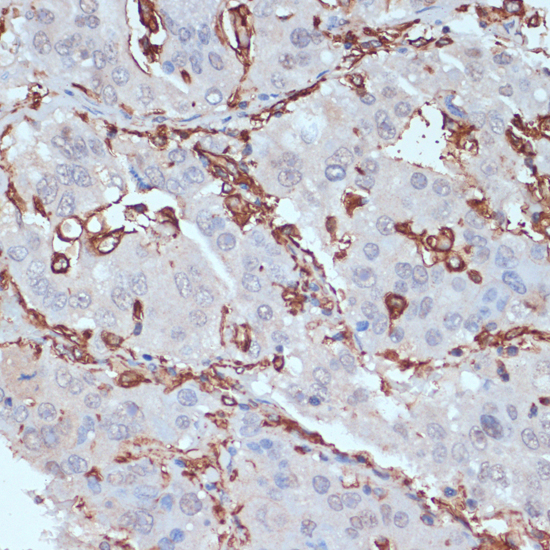 Immunohistochemistry - HLA-DRA Polyclonal Antibody 