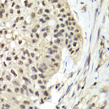 Immunohistochemistry - RFC5 Polyclonal Antibody 