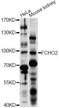 Western blot - FCHO2 Polyclonal Antibody 