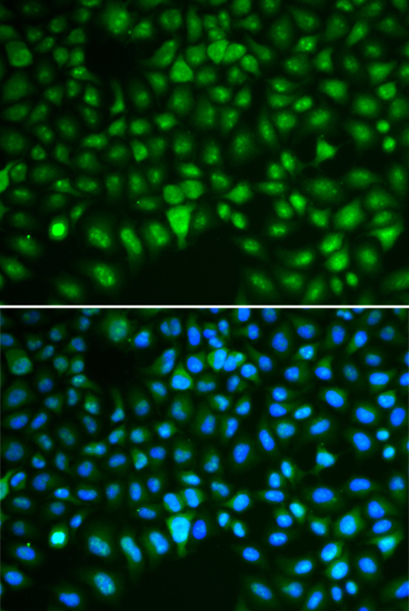 Immunofluorescence - DLGAP5 Polyclonal Antibody 