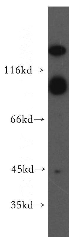 human brain tissue were subjected to SDS PAGE followed by western blot with Catalog No:112601(GRM2 antibody) at dilution of 1:300