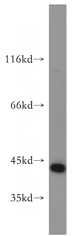 HepG2 cells were subjected to SDS PAGE followed by western blot with Catalog No:112488(SERPINB5 antibody) at dilution of 1:500