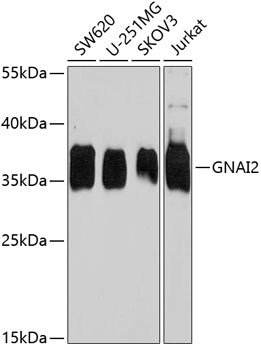 Western blot - GNAI2 Polyclonal Antibody 