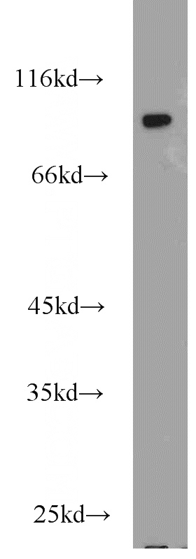 HeLa cells were subjected to SDS PAGE followed by western blot with Catalog No:109851(DAB2 antibody) at dilution of 1:1000
