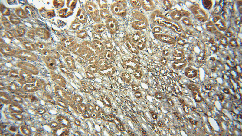 Immunohistochemical of paraffin-embedded human kidney using Catalog No:109573(DPYSL3 antibody) at dilution of 1:100 (under 10x lens)
