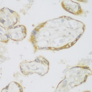 Immunohistochemistry - ERLIN1 Polyclonal Antibody 