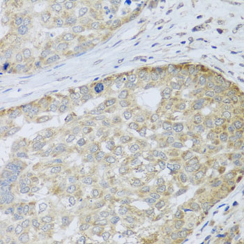 Immunohistochemistry - ANAPC10 Polyclonal Antibody 