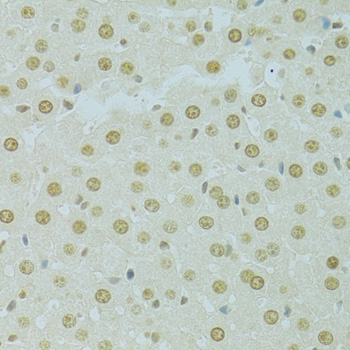 Immunohistochemistry - RCC1 Polyclonal Antibody 