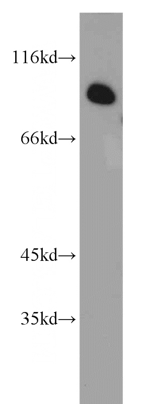 mouse lung tissue were subjected to SDS PAGE followed by western blot with Catalog No:109073(CCPG1 antibody) at dilution of 1:800
