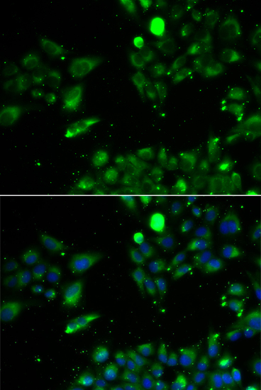 Immunofluorescence - UQCRFS1 Polyclonal Antibody 