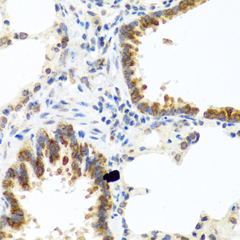 Immunohistochemistry - C8orf4 Polyclonal Antibody 