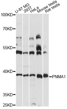 Western blot - PNMA1 Polyclonal Antibody 