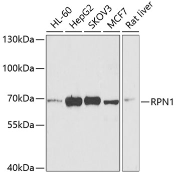 Western blot - RPN1 Polyclonal Antibody 