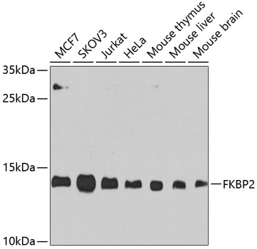 Western blot - FKBP2 Polyclonal Antibody 