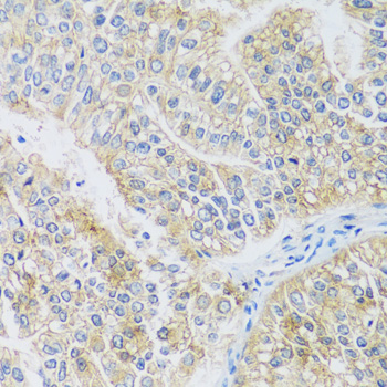 Immunohistochemistry - ARPC1A Polyclonal Antibody 