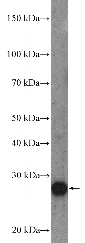 Jurkat cells were subjected to SDS PAGE followed by western blot with Catalog No:116534(UBE2R2 Antibody) at dilution of 1:600