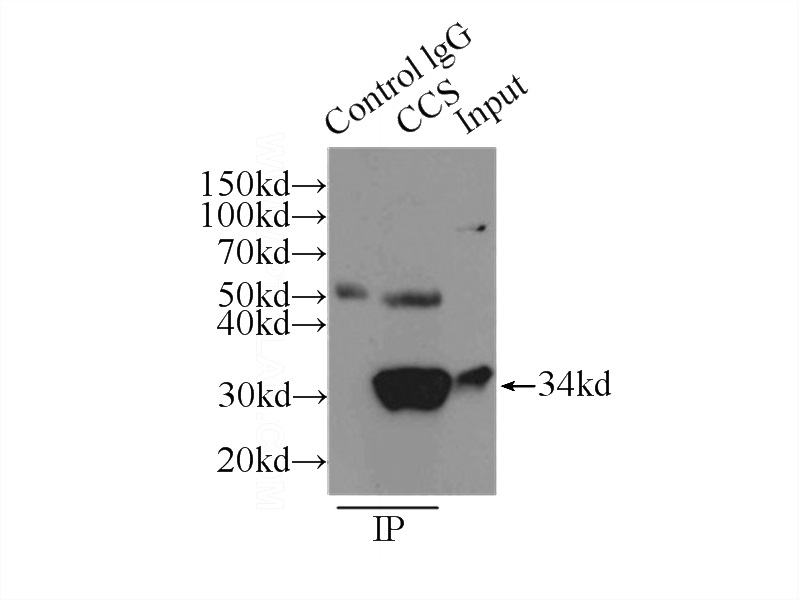 IP Result of anti-CCS (IP:Catalog No:109080, 3ug; Detection:Catalog No:109080 1:1000) with HepG2 cells lysate 6000ug.