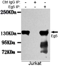 Immunoprecipitation analysis of Jurkat cell lysates using Eg5 mouse mAb.