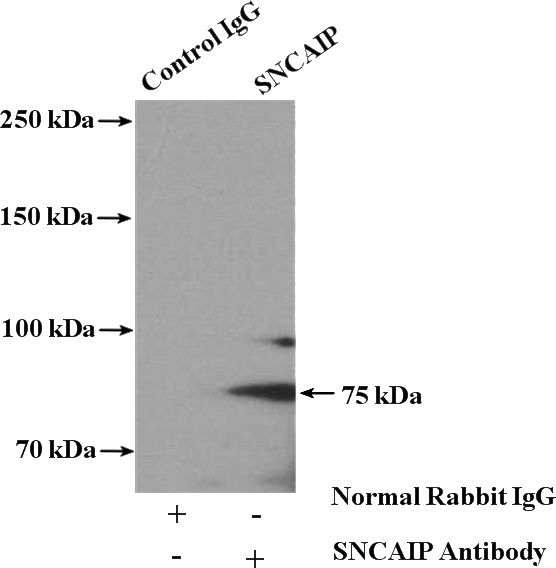 IP Result of anti-SNCAIP (IP:Catalog No:115450, 4ug; Detection:Catalog No:115450 1:300) with mouse brain tissue lysate 3600ug.
