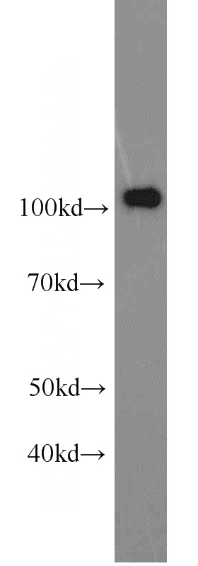 A431 cells were subjected to SDS PAGE followed by western blot with Catalog No:107478(PMS2 antibody) at dilution of 1:1000