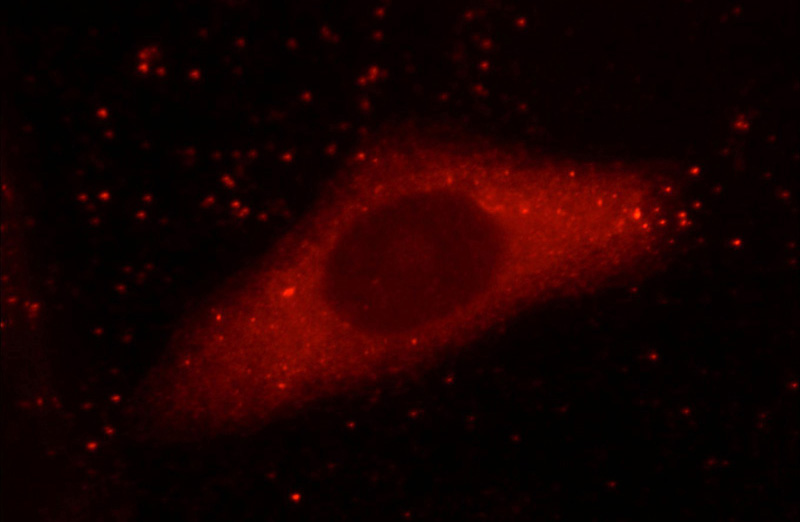 Immunofluorescent analysis of HepG2 cells using Catalog No:109382(COL4A5 Antibody) at dilution of 1:25 and Rhodamine-Goat anti-Rabbit IgG