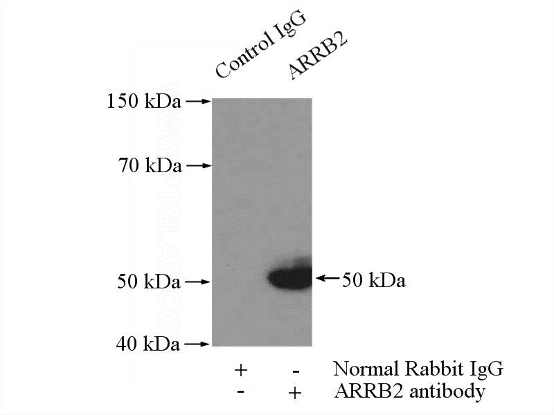 IP Result of anti-Beta Arrestin 2 (IP:Catalog No:117126, 4ug; Detection:Catalog No:117126 1:1000) with RAW 264.7 cells lysate 4000ug.