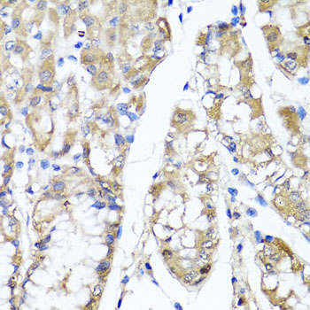 Immunohistochemistry - TNFAIP6 Polyclonal Antibody 