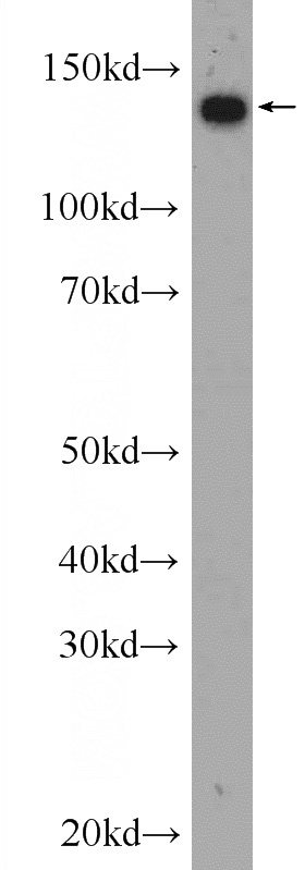 HEK-293 cells were subjected to SDS PAGE followed by western blot with Catalog No:113029(NCAPD2 Antibody) at dilution of 1:600