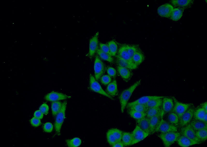 Immunofluorescent analysis of HeLa cells using Catalog No:111641(NFKBIA Antibody) at dilution of 1:25 and Alexa Fluor 488-congugated AffiniPure Goat Anti-Rabbit IgG(H+L)