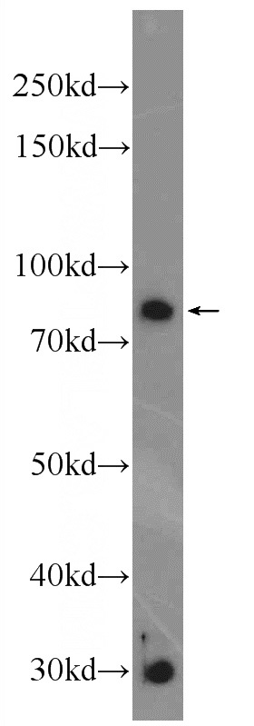 SGC-7901 cells were subjected to SDS PAGE followed by western blot with Catalog No:116741(C14orf115 Antibody) at dilution of 1:300