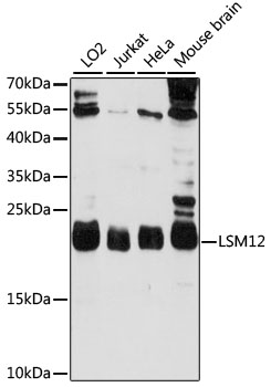 Western blot - LSM12 Polyclonal Antibody 