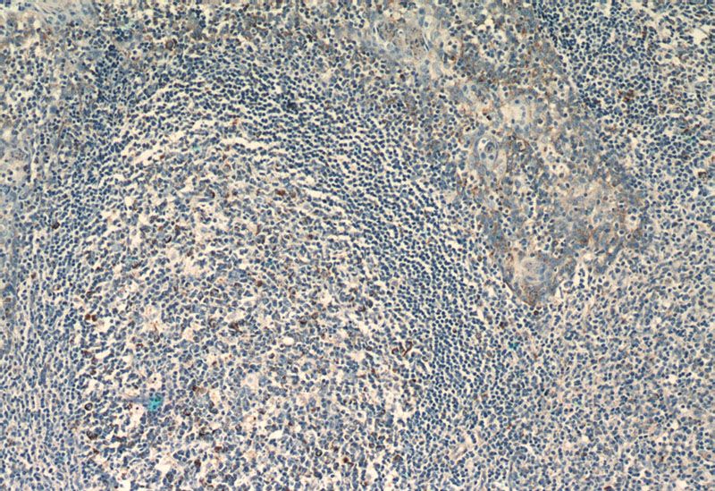 Immunohistochemistry of paraffin-embedded human tonsillitis slide using Catalog No:108686(C1QBP Antibody) at dilution of 1:50