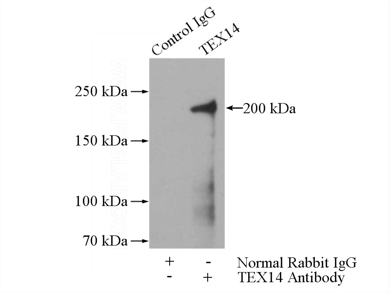 IP Result of anti-TEX14 (IP:Catalog No:115959, 4ug; Detection:Catalog No:115959 1:500) with mouse testis tissue lysate 4000ug.