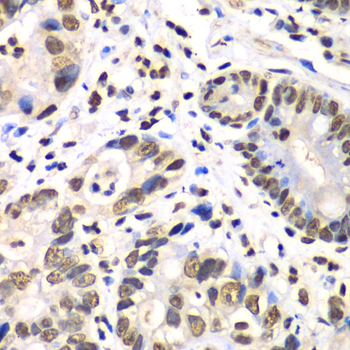 Immunohistochemistry - RBBP7 Polyclonal Antibody 