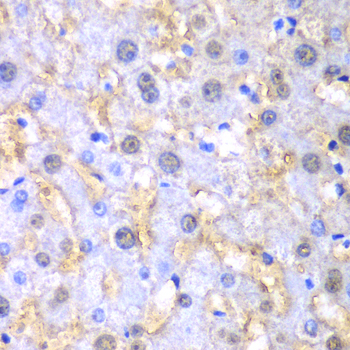 Immunohistochemistry - FAH Polyclonal Antibody 