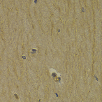 Immunohistochemistry - DRD3 Polyclonal Antibody 