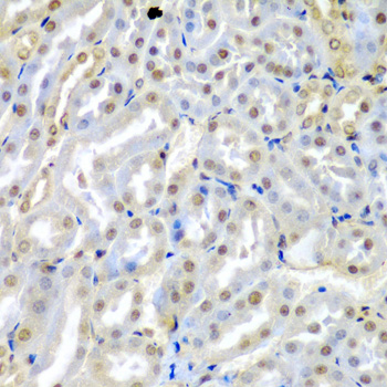 Immunohistochemistry - TUSC2 Polyclonal Antibody 