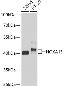 Western blot - HOXA13 Polyclonal Antibody 