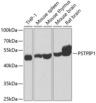 Western blot - PSTPIP1 Polyclonal Antibody 
