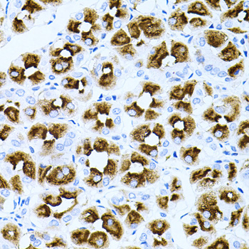 Immunohistochemistry - DLK1 Polyclonal Antibody 